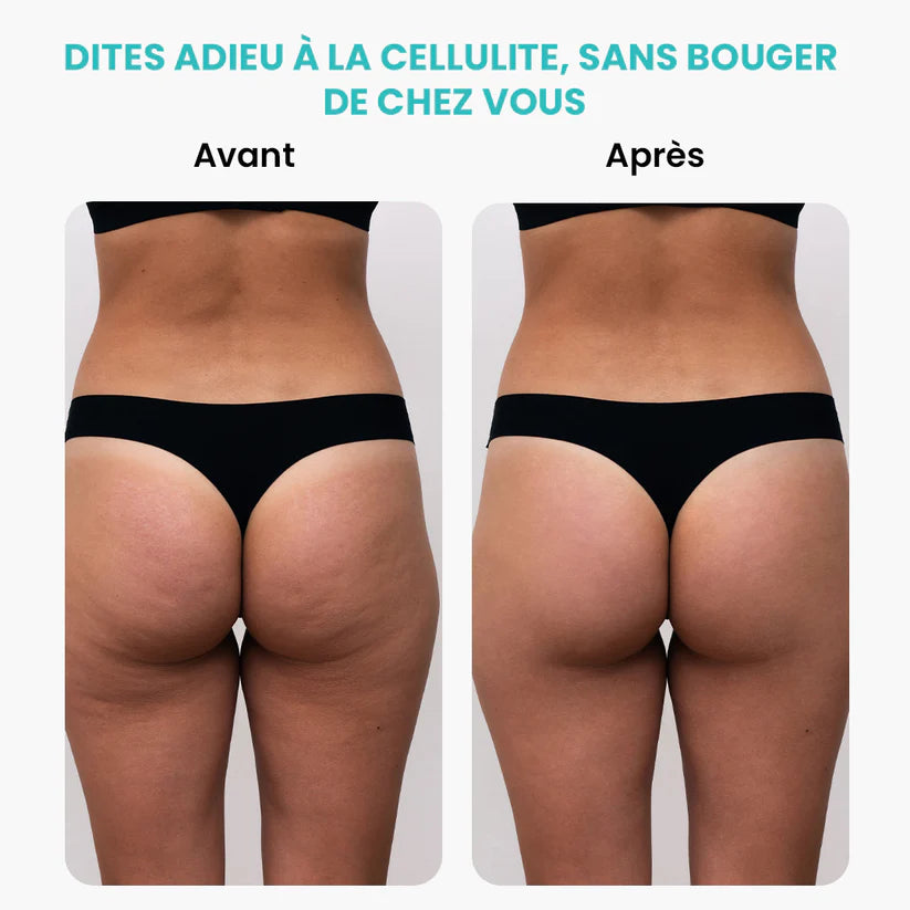 Masseur Brûleur de Graisses Électrique Rotatif – Anti-Cellulite & Minceur